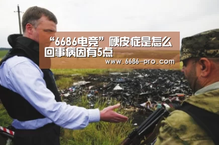 “6686电竞”硬皮症是怎么回事病因有5点(图2) 6686电竞